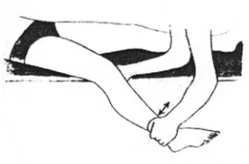Gambar 4.3.Hipermobilitas valgus (de wolf, 1994)  