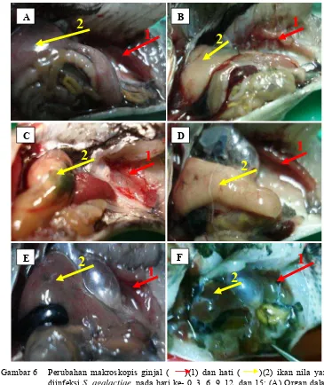 Gambar 6 Perubahan makroskopis ginjal (    )(1) dan hati (     )(2) ikan nila yang diinfeksi S