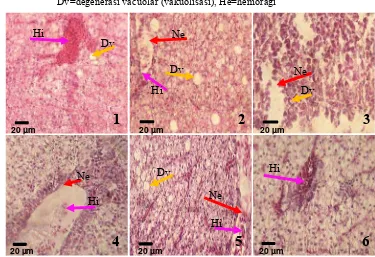 Gambar 8 Histopatologi hati ikan nila yang di infeksi bakteri S. agalactiae tipe β-