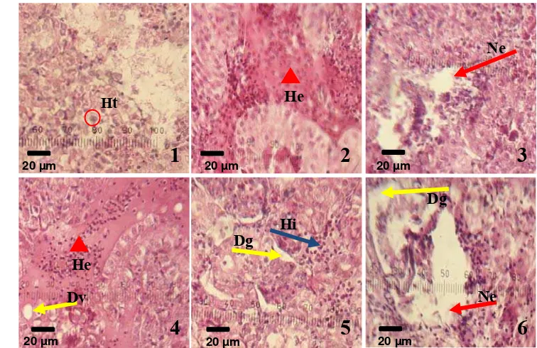 Gambar 14 Histopatologi ginjal ikan nila yang di infeksi bakteri S. agalactiae tipe β-hemolitik; Hi=hiperemi, Ne=nekrosis, Dg=degenerasi, He=hemoragi 