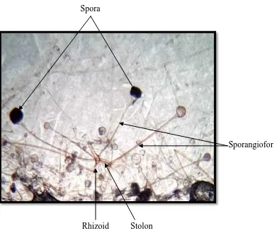 Gambar 4.3. Struktur Rhizopus sp. sebagai pembanding 