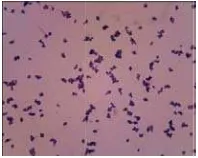 Gambar 1. HasGsil pengecatann gram bakterri Staphylococccus aureus 