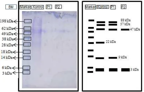 Gambar 1. Gambar Profil Protein Membran Spermatozoa Tikus (kontrol, perlakuan 1, perlakuan 2), (a) Gambar Hasil Elektroforesis SDS-PAGE (b) Zimogram Hasil Elektroforesis 