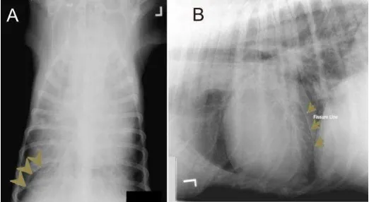 Gambar 31 Radiografi kejadian lobar sign pada posisi DV/VD (A) dan posisi lateral (B) yang di tandai dengan arah panah hitam (O'Sullivan & O'Grady 2010) (modifikasi)