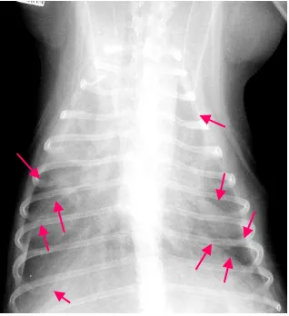 Gambar 33  Radiografi leafing of lung lobes yang di tandai dengan arah panah berwarna ping  pada posisi dorsoventral (O'Sullivan & O'Grady 2010) (modifikasi)