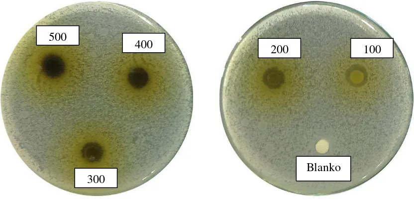 Gambar hasil uji aktivitas antibakteri fraksi air daun beluntas terhadap bakteri Eschericia coli 