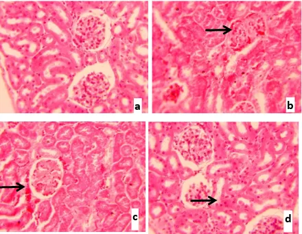 Gambar 2.  Potongan melintang ginjal mencit jantan dengan pewarnaan HE dan pembesaran 400x, (a) Gambaran sel-sel ginjal normal pada kelompok kontrol tanpa perlakuan, (b) Histopatologi ginjal terjadi penyempitan kapsula Bowman pada kelompok P5, (c) Histopatologi ginjal terjadi kongesti pada kelompok P5, (d) Histopatologi ginjal terjadi nekrosis pada 
