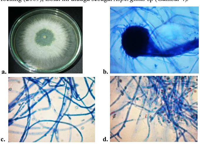 Gambar 4. Morfologi makro dan mikroskopis isolat jamur RH03. (a) Koloni jamur pada media SDA pada masa inkubasi 7 hari