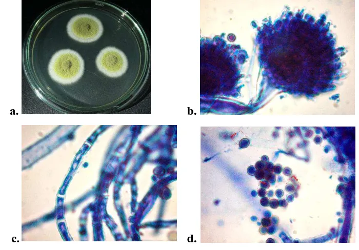 Gambar 5. Morfologi makro dan mikroskopis isolat jamur RH06.  