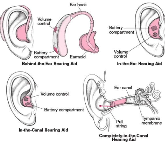 Figure 2.2 Types of hearing aids 