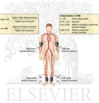 Gambar 1. Pengukuran dan interpretasi  ankle-brachial index (ABI). DP = 