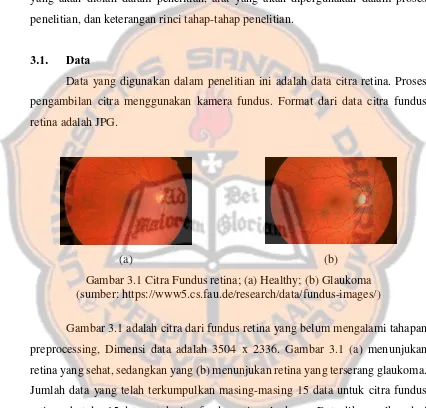 Gambar 3.1 Citra Fundus retina; (a) Healthy; (b) Glaukoma 