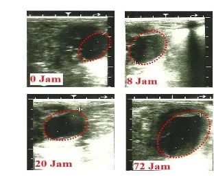 Gambar 5  Gambaran ultrasonografi folikel (garis putus-putus) bersifat  