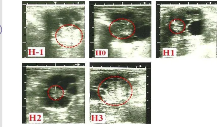 Gambar 4  Gambaran ultrasonografi perubahan korpus luteum (garis putus-putus). Pada hari  