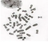 Gambar kromosom