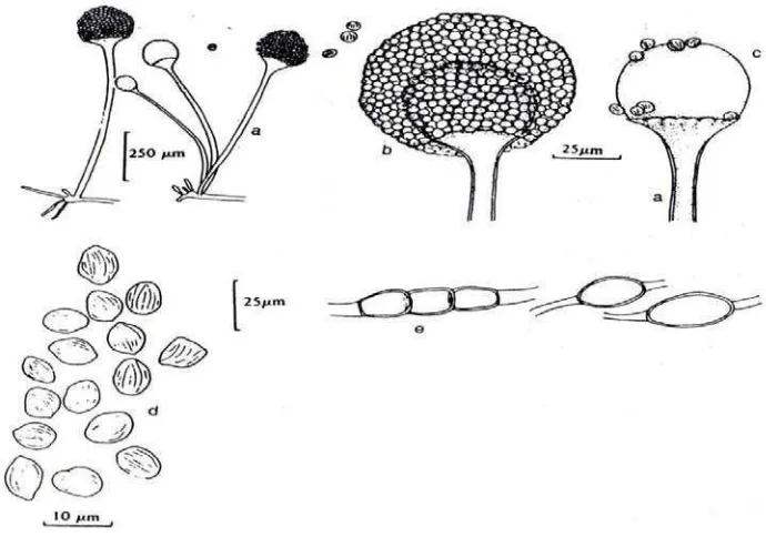 Gambar 2. Bentuk dan komponen-komponen sel  Rhizopus oryzae : a.Sporangiofor b.Sporangium c.Kolumela d.Sporangiospora e.Khlamidospora (Gandjar et al.,1999) 