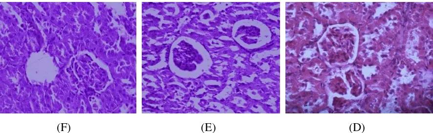 Gambar 5.6. Perbandingan histopatologi glomerulus ginjal kelompok kontrol DM 