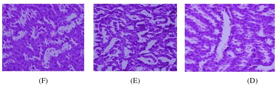 Gambar  5.8. Perbandingan histopatologi glomerulus ginjal kelompok kontrol DM 