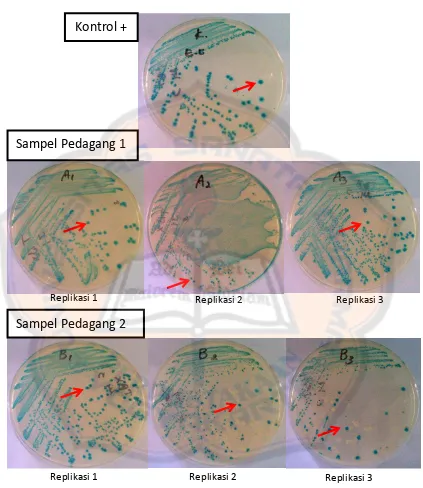 Gambar 4. Hasil isolasi  E.coli pada sampel jamu beras kencur dalam media Tryptone Bile X-Glucuronide (TBX) 