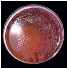 Gambar 3 Koloni E. coli pada media LEMB agar. 