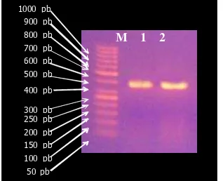 Gambar 1. Koloni E. coli DH5α pembawa plasmid pGEX-HB100hasil transformasi yang ditumbuhkan pada media seleksi (ampisilin)
