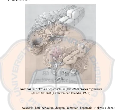 Gambar 3. Nekrosis hepatoselular (kiri atas) proses regenerasi (kanan bawah) (Cameron dan Blendis, 1996) 