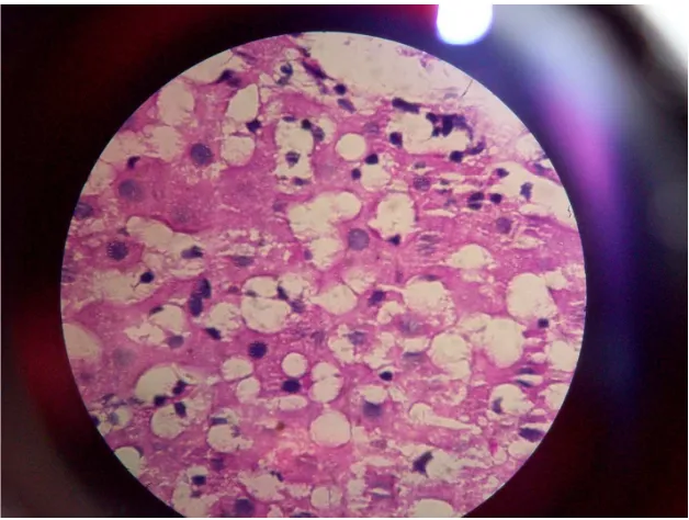 Gambar 1. Gambaran mikroskopis kelompok dosis I 