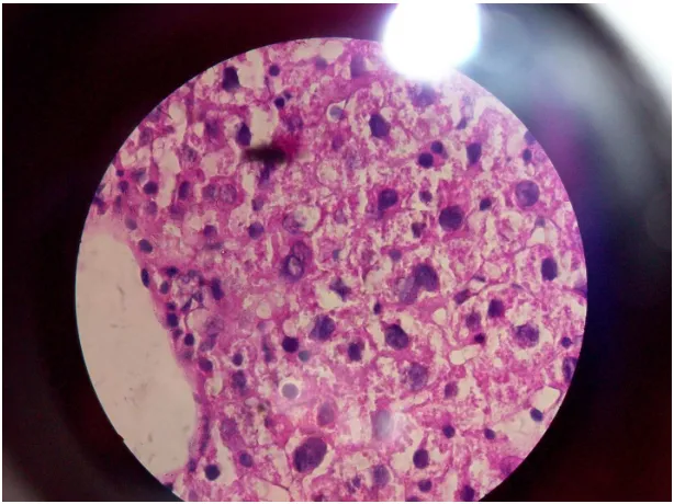Gambar 2. Gambaran mikroskopis kelompok dosis II 