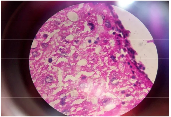 Gambar L.2.3 Mikroskopis hati mencit kelompok I (dosis I +CCl4) 