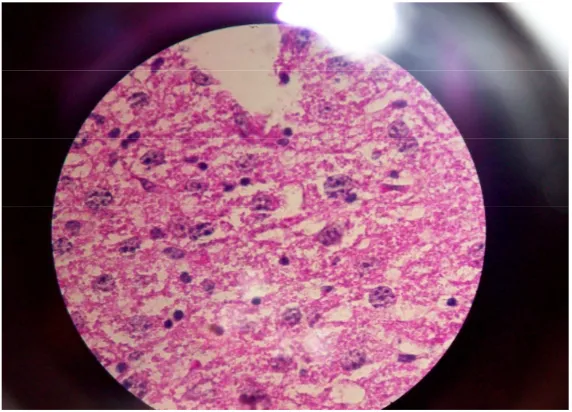 Gambar L.2.5 Mikroskopis hati mencit kelompok III (dosis III + CCl4) 
