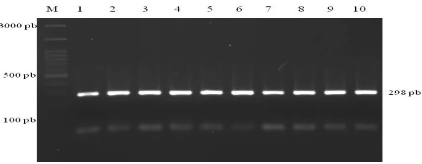 Gambar 1. Visualisasi hasil amplifikasi ruas gen GHR pada gel agarose 1,5%. M = Marker 100 pasang basa (pb), 1-10 = nomor sampel 