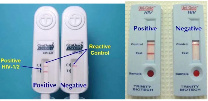 Gambar 2.12  Prinsip reaksi antibody capture assay pada uji anti HIV (Stanley, 