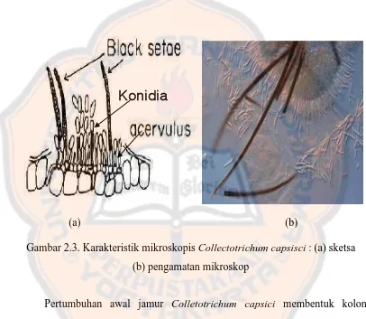Gambar 2.3. Karakteristik mikroskopis Collectotrichum capsisci : (a) sketsa  