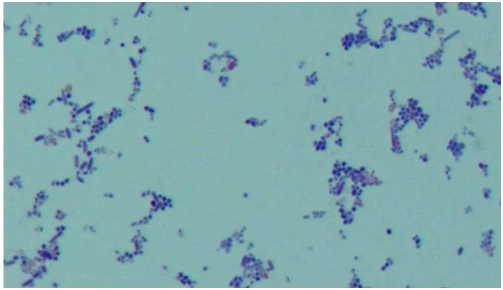 Gambar 4.1 Bakteri S.mutans dengan pengecatan gram 