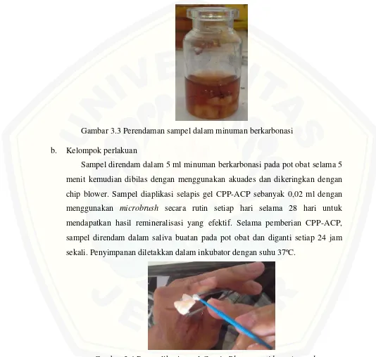 Gambar 3.4 Pengaplikasian gel Casein Phospopeptides – Amorphous Calcium Phosphate (CPP-ACP) 