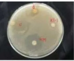 Figure 2. The diameter of inhibition zone ethanol extract of the leaves and bulbs of garlic against  Shigella sonnei  