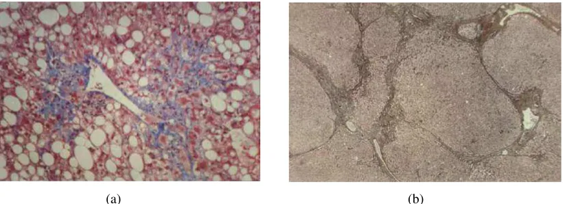 Gambar 2.6 Histopatologi hepar (Sumber: www.meddean.luc.edu) 
