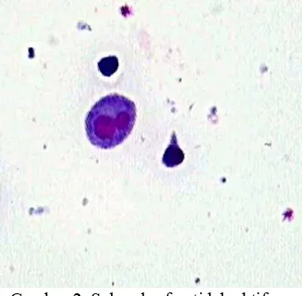 Gambar 2. Sel makrofag tidak aktif