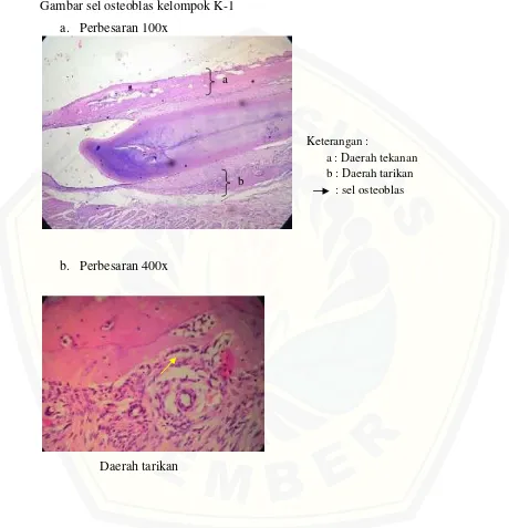 Gambar sel osteoblas kelompok K-1