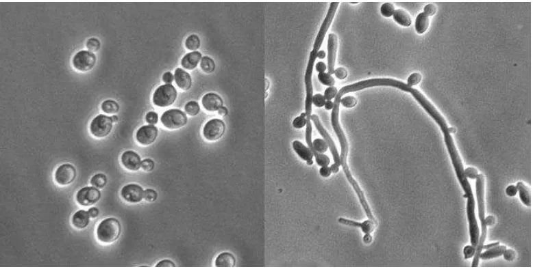 Gambar 2.2 Bentukan mikroskopis  Candida albicans, Hifa (A) dan Spora (B) (Anonimous, 