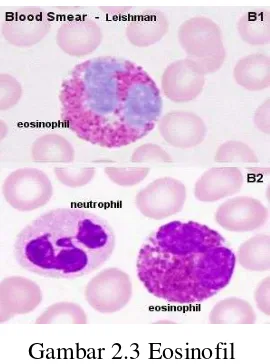 Gambar 2.3 Eosinofil 