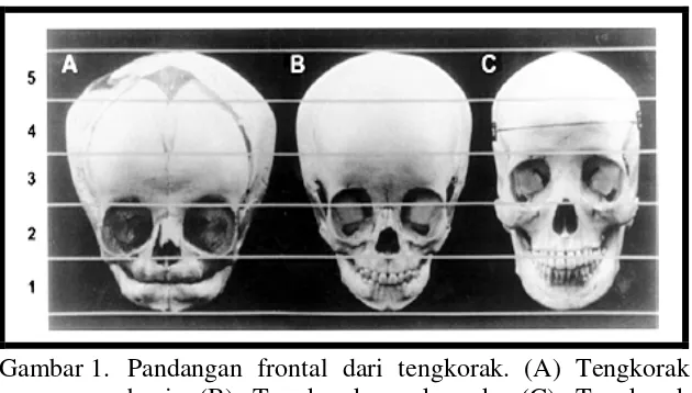 Gambar 1. Pandangan frontal dari tengkorak. (A) Tengkorak 