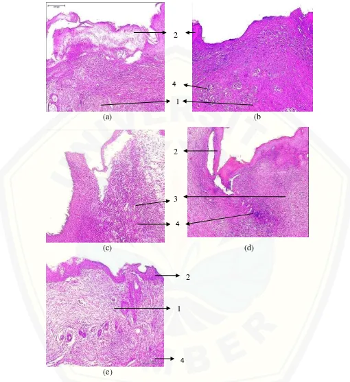 Gambar 4.1. Histopatologi kulit tikus dengan pewarnaan Haematoxylin-