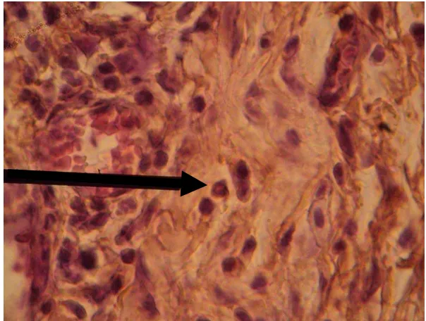 Gambar 4.1 Sel PMN neutrofil gingiva tikus wistar jantan yang dihitung pada semua      kelompok