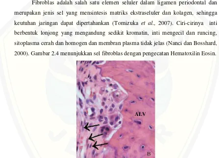 Gambar 2.4 Foto mikroskopik fibroblas (anak panah), tulang alveolar (ALV), Ligamen 
