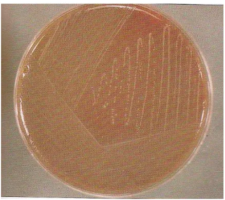 Gambar 2.8 Koloni Lactobacillus acidophilus  (Tony, 1997:111) 
