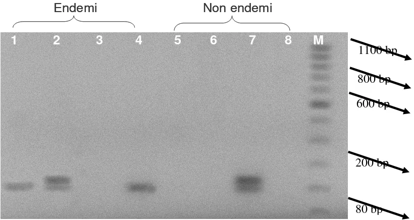 Gambar 4.     Pola fragmen DNA F. oxysporumKeterangan : 1 : isolat FCp1, 2 : isolat FCp2, 3 : isolat FCp3, 4 : isolat FCp4, 5 :  f