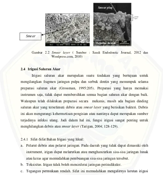 Gambar 2.2 Smear layer ( Sumber : Saudi Endodontic Journal, 2012 dan 