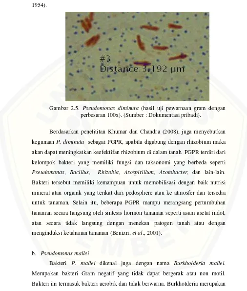 Gambar 2.5. Pseudomonas diminuta (hasil uji pewarnaan gram dengan 
