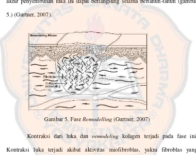 Gambar 5. Fase Remodelling (Gurtner, 2007) 